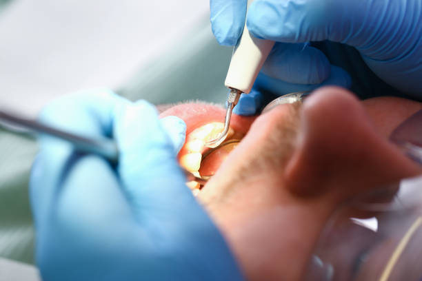 Best Emergency Gum Treatment in Branford Center, CT